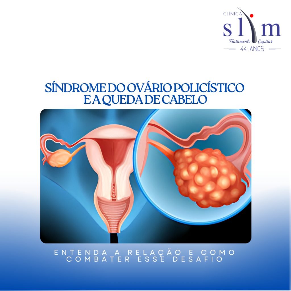 Capa Blog (2)
